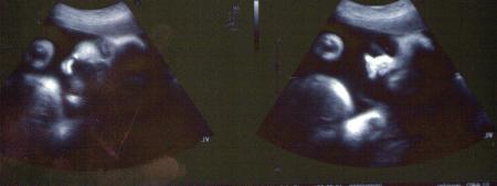 contrendu de lecho du 3em trimestre